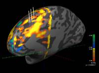 Функциональная МРТ