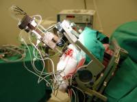 Метод стереотаксической хирургии