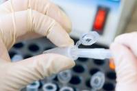 Рак простаты и ПСА - когда нужно начать лечение?