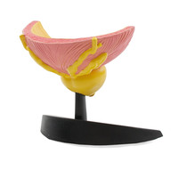 Рецидив рака мочевого пузыря