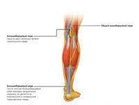 Стимуляция заднего большеберцового нерва для лечения недержания